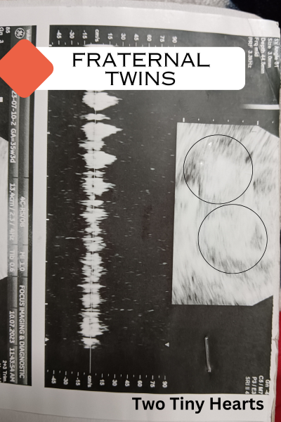 How Early Twins Can Be Detected