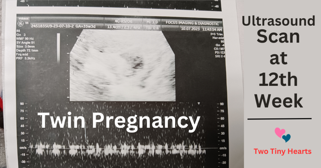 When Are Twins Identified In Pregnancy