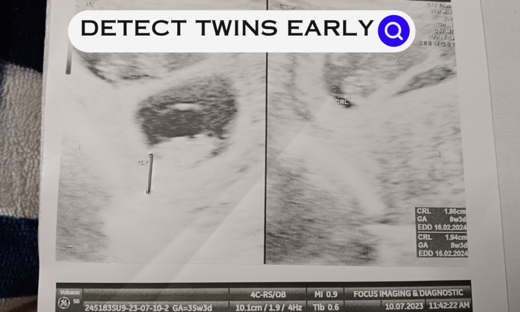 When Twins Are Detected In Pregnancy