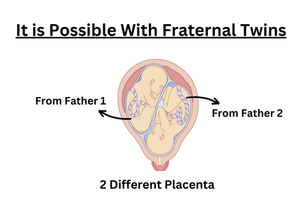 Twin Children Have Two Biological Fathers